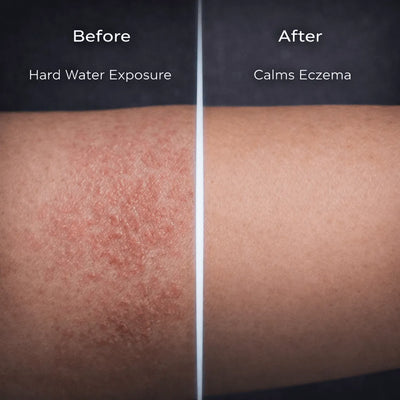 Solyn Pro Filtered Showerhead