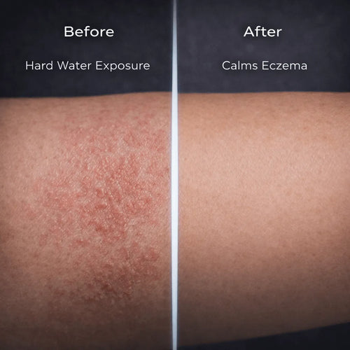 Solyn Pro Filtered Showerhead